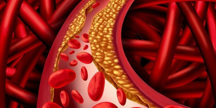 Health Care These changes happening in the body can be a sign of increasing cholesterol